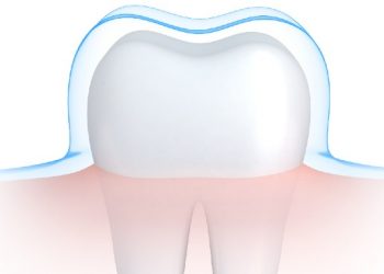 Dişler hakkında 5 şaşırtıcı gerçek