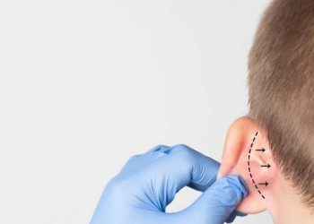 Kepçe Kulak Ameliyatı Ne Zaman Ve Kaç Yaşında Yapılır?