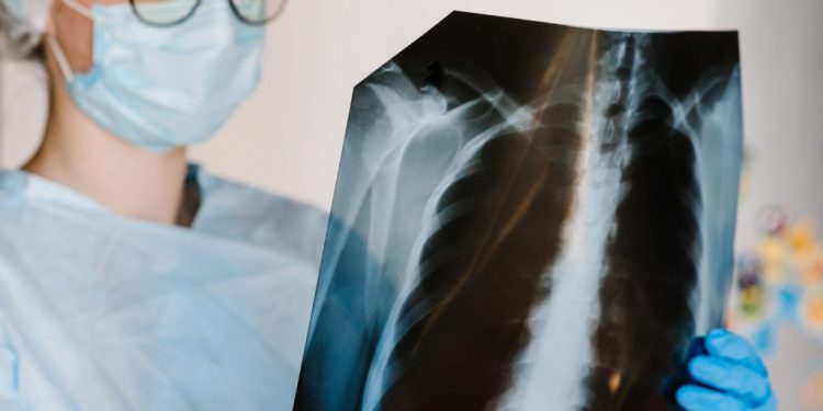 KOAH hastalığı idrar kaçırma riskini arttırıyor